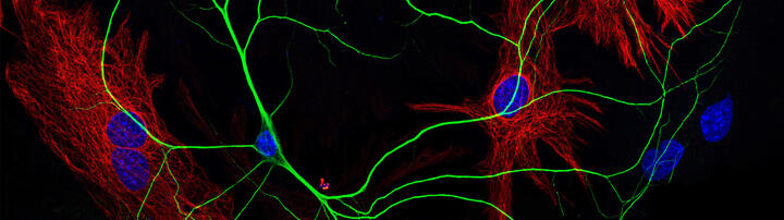 Kortikales Neuron auf einem Rasen aus Gliazellen