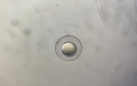 Ein wenige Stunden altes Zebrafisch-Ei unter dem Mikroskop, im Labor von Daniela Panáková