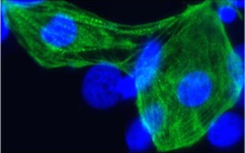 Die Forscher haben pluripotente Stammzellen unter anderem in Herzmuskelzellen umgewandelt.