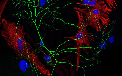 Kortikales Neuron auf einem Rasen aus Gliazellen